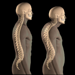 stress affects posture